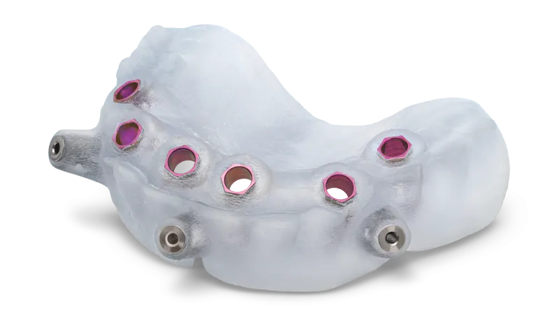 Surgical Guide İmplant Klavuz İmplant, Cerrahi Rehber İle İmplant