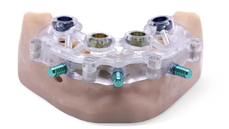 Surgical Guide İmplant Klavuz İmplant, Cerrahi Rehber İle İmplant